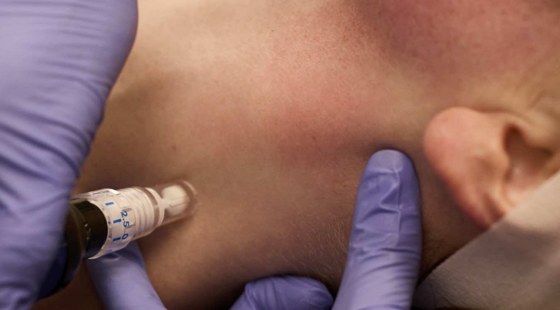 Microneedling Treatment on neck with therapist hands